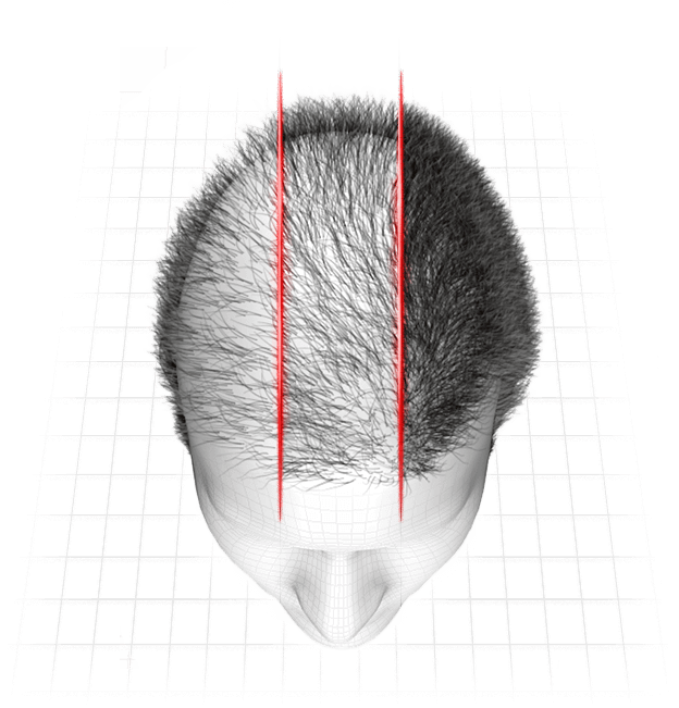 ilustração das fases do hair loss blocker