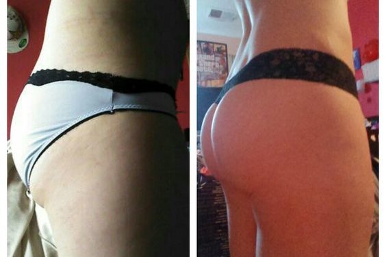 →Saiba como deixar o bumbum durinho sem fazer exercícios!