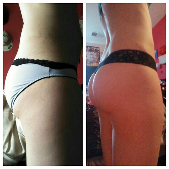 →Saiba como deixar o bumbum durinho sem fazer exercícios!